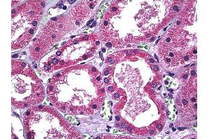 Anti-SLC11A2 antibody IHC of human kidney. (SLC11A2 antibody  (AA 1-66))