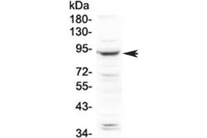 Western blot testing of human HeLa cell lysate with PLA2G6 antibody at 0.