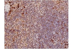 Immunohistochemistry (IHC) image for anti-Microtubule-Associated Protein tau (MAPT) (pSer235) antibody (ABIN6256205)