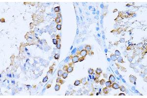 Immunohistochemistry of paraffin-embedded Mouse testis using CD63 Polyclonal Antibody at dilution of 1:100 (40x lens). (CD63 antibody)