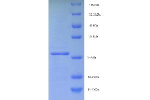 SDS-PAGE (SDS) image for C-Myc Binding Protein (MYCBP) (AA 2-103) protein (His-SUMO Tag) (ABIN4974468)