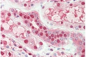 Human Kidney: Formalin-Fixed, Paraffin-Embedded (FFPE)