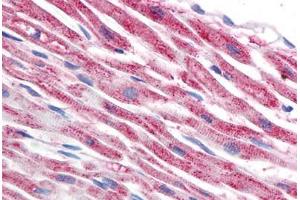 Human Heart (formalin-fixed, paraffin-embedded) stained with TUBB antibody ABIN239815 at 5 ug/ml followed by biotinylated anti-mouse IgG secondary antibody ABIN481714, alkaline phosphatase-streptavidin and chromogen. (TUBB antibody)