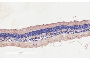 CNGB3 antibody  (AA 175-186)