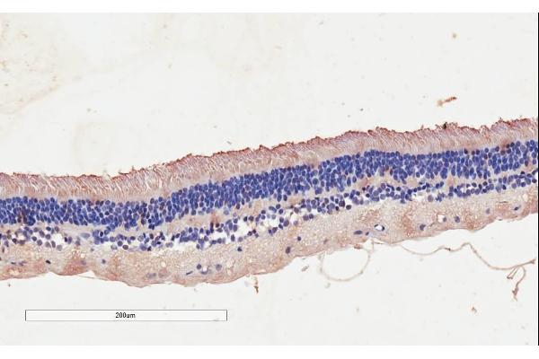 CNGB3 antibody  (AA 175-186)