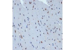 Immunohistochemistry of paraffin-embedded mouse heart using SUN2 Rabbit mAb (ABIN7270135) at dilution of 1:100 (40x lens). (SUN2 antibody)