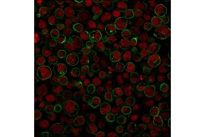 Immunohistochemistry (IHC) image for anti-Protein tyrosine Phosphatase, Receptor Type, C (PTPRC) antibody (ABIN6940464)