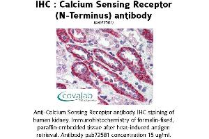 Image no. 1 for anti-Calcium-Sensing Receptor (CASR) (N-Term) antibody (ABIN2852376) (CASR antibody  (N-Term))