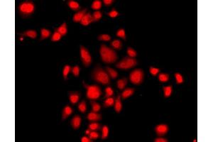 Immunofluorescence analysis of A549 cell using MLF1 antibody. (MLF1 antibody)