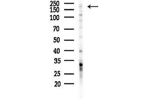 anti-Microtubule Associated serine/threonine Kinase 2 (MAST2) (Internal Region) antibody