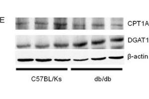 miR-30c-5p expression and triglyceride accumulation in db/db mice(A) Relative expression of miR-30c-5p among different organs. (DGAT1 antibody  (AA 200-300))