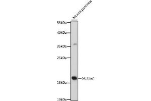 Western blot analysis of extracts of mouse pancreas, using Slc31a2 antibody (ABIN7270450) at 1:500 dilution. (SLC31A2 antibody  (AA 1-100))