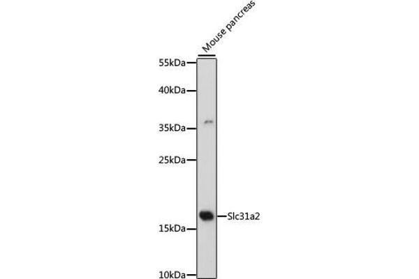 SLC31A2 抗体  (AA 1-100)