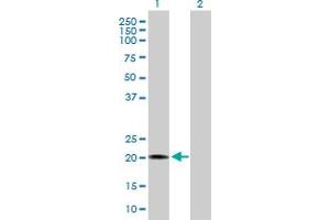 Western Blot analysis of RBBP9 expression in transfected 293T cell line by RBBP9 MaxPab polyclonal antibody. (RBBP9 antibody  (AA 1-186))