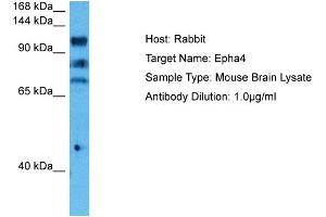 Host: Mouse Target Name: EPHA4 Sample Tissue: Mouse Brain Antibody Dilution: 1ug/ml (EPH Receptor A4 antibody  (C-Term))