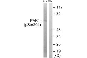 Western blot analysis of extracts from 3T3 cells, treated with UV (15mins), using PAK1 (Phospho-Ser204) antibody. (PAK1 antibody  (pSer204))