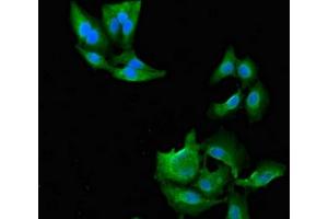 Immunofluorescent analysis of Hela cells using ABIN7144675 at dilution of 1:100 and Alexa Fluor 488-congugated AffiniPure Goat Anti-Rabbit IgG(H+L) (NAT1 antibody  (AA 1-288))