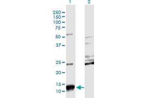 Western Blot analysis of SCGB2A2 expression in transfected 293T cell line by SCGB2A2 monoclonal antibody (M08), clone 3A4. (Mammaglobin A antibody  (AA 1-93))