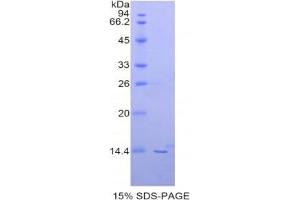 SDS-PAGE analysis of Human PIN4 Protein. (PIN4 Protein)