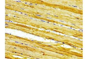 Immunohistochemistry of paraffin-embedded human skeletal muscle tissue using ABIN7146585 at dilution of 1:100 (CASQ2 antibody  (AA 219-300))