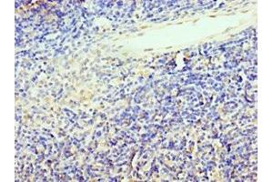 Immunohistochemistry of paraffin-embedded human thymus tissue using ABIN7172449 at dilution of 1:100 (TCF12 antibody  (AA 443-682))