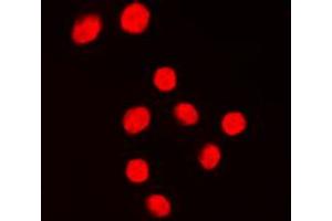 Immunofluorescent analysis of KLF1/5/7 staining in Jurkat cells. (KLF1/5/7 antibody  (C-Term))