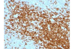 Formalin-fixed, paraffin-embedded human Tonsil stained with CD43 Mouse Monoclonal Antibody (SPN/1094). (CD43 antibody)