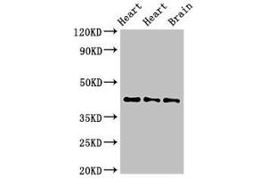 Western Blot Positive WB detected in: Rat heart tissue, Mouse heart tissue, Mouse brain tissue All lanes: NPSR1 antibody at 4 μg/mL Secondary Goat polyclonal to rabbit IgG at 1/50000 dilution Predicted band size: 43, 36, 45, 44, 42, 19, 16, 17, 11 kDa Observed band size: 43 kDa