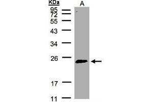 WB Image Sample(30 μg of whole cell lysate) A:HeLa S3, 12% SDS PAGE antibody diluted at 1:500 (RAB2A antibody  (C-Term))