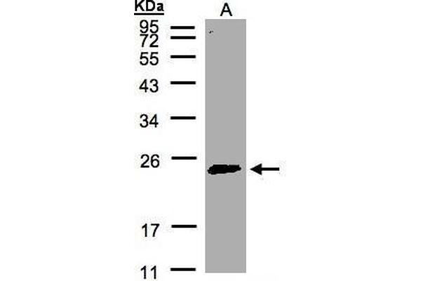 RAB2A anticorps  (C-Term)