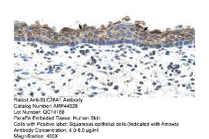 Human Skin (SLC26A1 antibody  (C-Term))