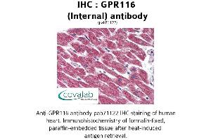 Image no. 2 for anti-G Protein-Coupled Receptor 116 (GPR116) (Internal Region) antibody (ABIN1734908)