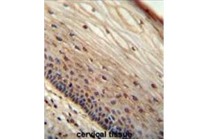 WIBG antibody (N-term) immunohistochemistry analysis in formalin fixed and paraffin embedded human cervical tissue followed by peroxidase conjugation of the secondary antibody and DAB staining. (PYM antibody  (N-Term))