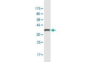 Western Blot detection against Immunogen (36. (TLN1 antibody  (AA 1324-1424))