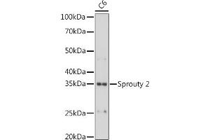 Western blot analysis of extracts of C6 cells, using Sprouty 2 antibody (ABIN7270554) at 1:1000 dilution. (SPRY2 antibody)