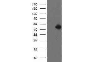 HEK293T cells were transfected with the pCMV6-ENTRY control (Left lane) or pCMV6-ENTRY PBX1 (Right lane) cDNA for 48 hrs and lysed. (PBX1 antibody)