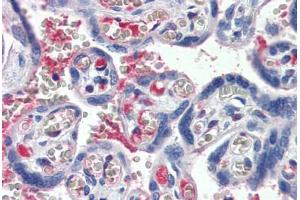 Human Placenta (formalin-fixed, paraffin-embedded) stained with C1S antibody ABIN364242 at 5 ug/ml followed by biotinylated anti-goat IgG secondary antibody ABIN481715, alkaline phosphatase-streptavidin and chromogen. (C1S antibody)