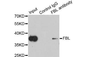Immunoprecipitation analysis of 200ug extracts of HeLa cells using 1ug FBL antibody. (Fibrillarin antibody)