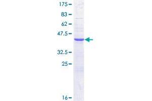 CST1 Protein (AA 1-141) (GST tag)