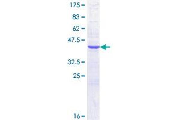 CST1 Protein (AA 1-141) (GST tag)