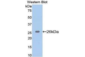 Western Blotting (WB) image for anti-BH3 Interacting Domain Death Agonist (BID) (AA 1-195) antibody (ABIN1077862)