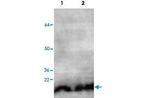 Western blot analysis of HeLa (Lane 1) and HEK293 (Lane 2) cell lysate with NUDT1 polyclonal antibody  at 1 : 500 dilution. (NUDT1 antibody  (C-Term))