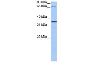 WB Suggested Anti-NLGN4X Antibody Titration:  0. (Neuroligin 4 antibody  (N-Term))