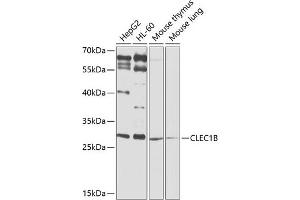 Western blot analysis of extracts of various cell lines, using CLEC1B antibody (ABIN6130012, ABIN6138705, ABIN6138706 and ABIN6225314) at 1:1000 dilution. (C-Type Lectin Domain Family 1, Member B (CLEC1B) (AA 22-196) antibody)