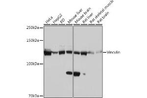 Western blot analysis of extracts of various cell lines, using Vinculin Rabbit mAb (ABIN3016604, ABIN3016605, ABIN1680530 and ABIN1680531) at 1:1000 dilution. (Vinculin antibody)