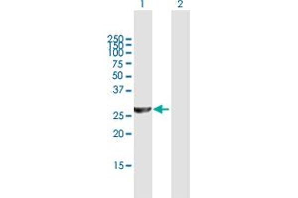 PSMC3IP Antikörper  (AA 1-217)