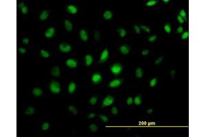 Image no. 4 for anti-CAMP Responsive Element Binding Protein 5 (CREB5) (AA 1-100) antibody (ABIN599087) (CREB5 antibody  (AA 1-100))