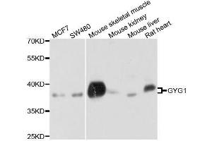 Western blot analysis of extracts of various cell lines, using GYG1 antibody. (Glycogenin 1 antibody  (AA 234-333))