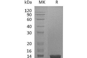 Western Blotting (WB) image for Macrophage Migration Inhibitory Factor (Glycosylation-Inhibiting Factor) (MIF) protein (His tag) (ABIN7320614) (MIF Protein (His tag))