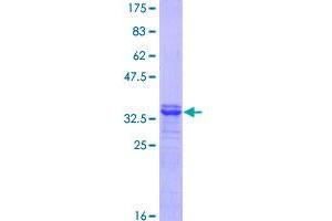 SLC7A1 Protein (AA 431-492) (GST tag)